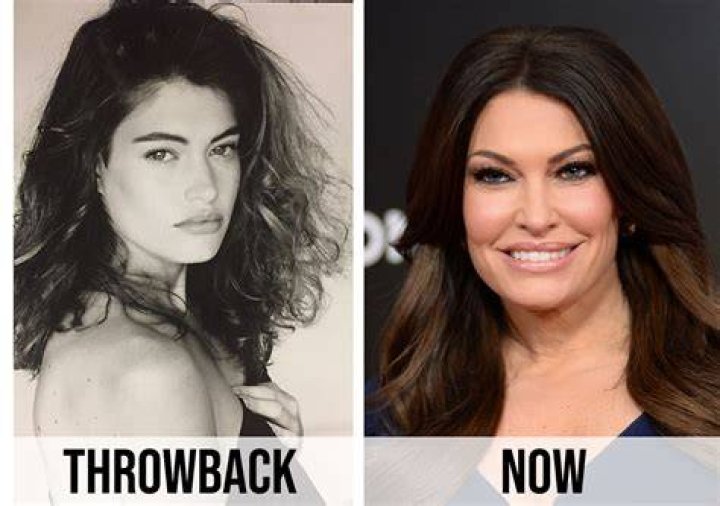 Exploring The Transformation: Kimberly Ann Guilfoyle's Plastic Surgery Journey