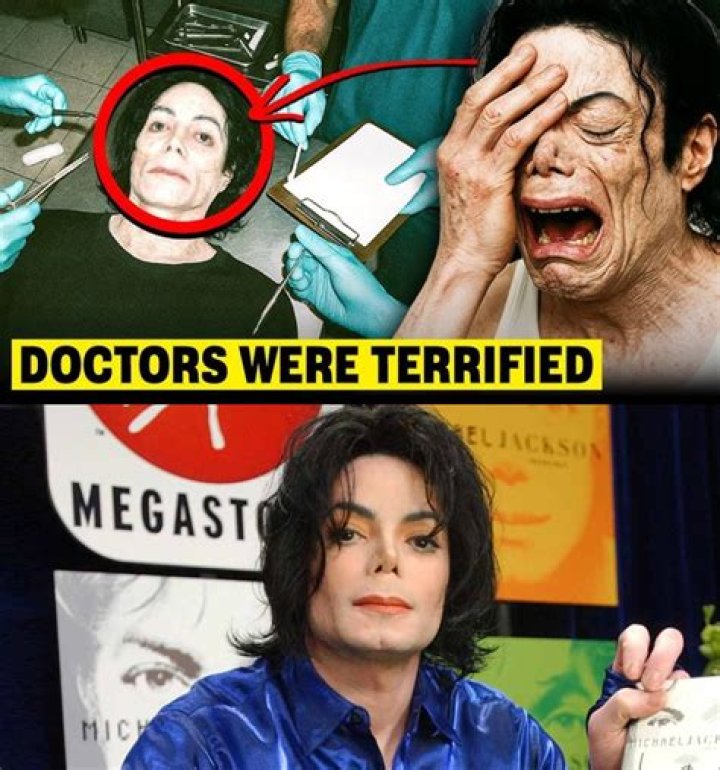 Michael Jackson S Autopsy Photos Shown In Court Essence Vrogue
