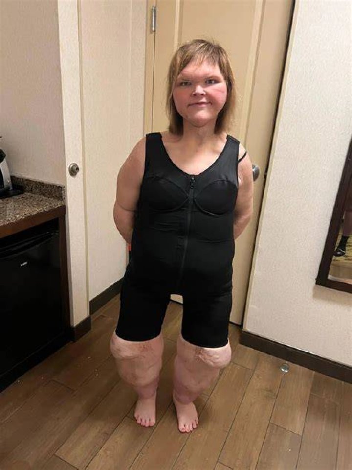 Why does Tammy Slaton have a trach on 1000lb Sisters?